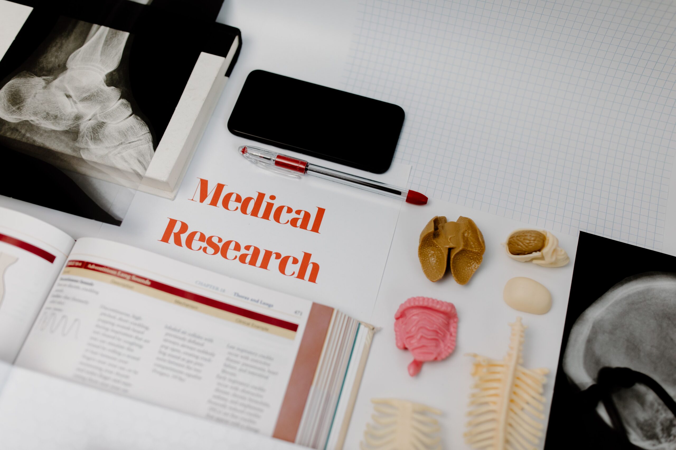 Medical research materials, anatomy models, and X-ray images arranged on a desk